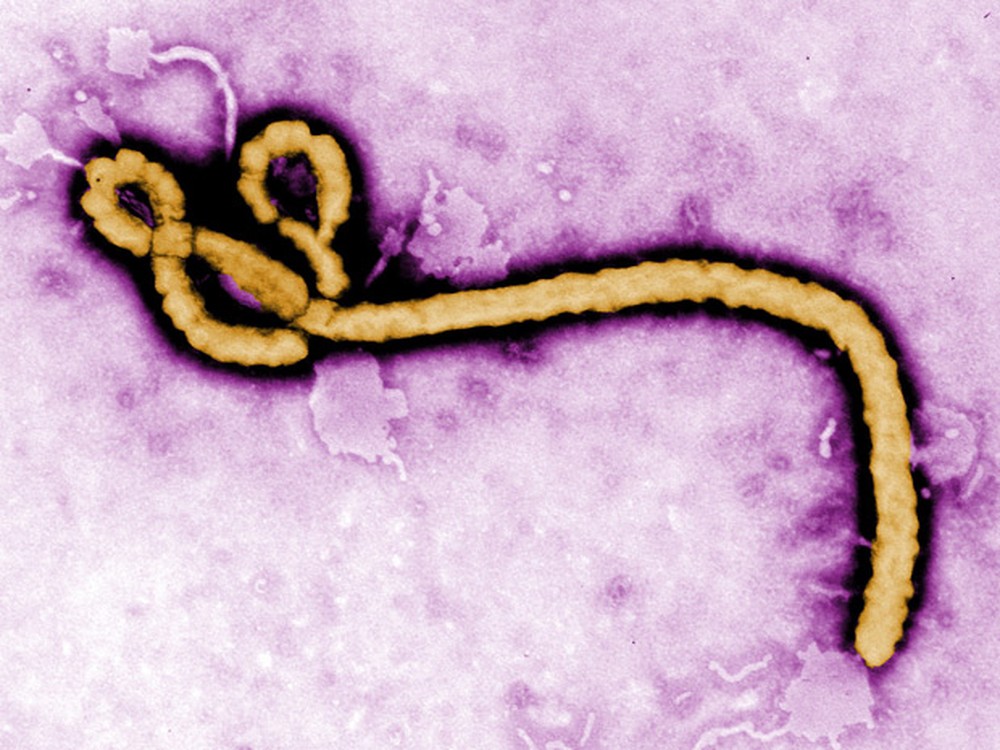 Cientistas descobrem protena capaz de impedir reproduo do vrus ebola